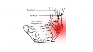 Kukšnies trauma